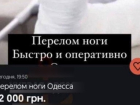 В Одессе предлагают сломать ногу за 12 тысяч гривен ради отсрочки от мобилизации