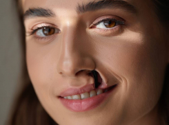 В Одессе врач убил девушку с волчьей пастью и заплатил за это 700 тысяч рублей