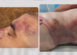 Появились фото мужчины, убитого в ТЦК в Одесской области – на них видны следы избиения