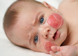 В Одесской области шестилетняя девочка сожгла феном лицо младенцу