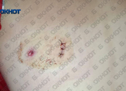 В Одесской области ВСУшник подстрелил 15-летнюю школьницу из пневматической винтовки